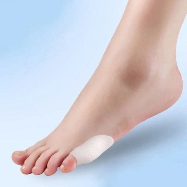 Обработка малого пальца ноги при деформации скручивании </br>поражении грибковой инфекцией
